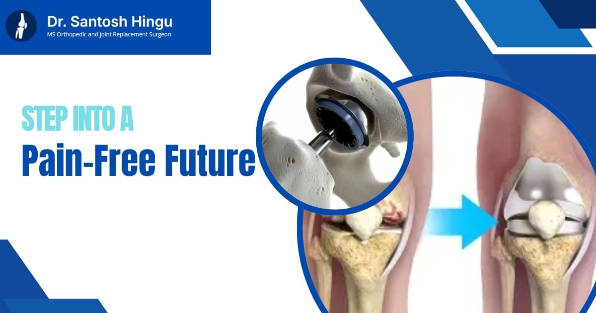 knee replacement