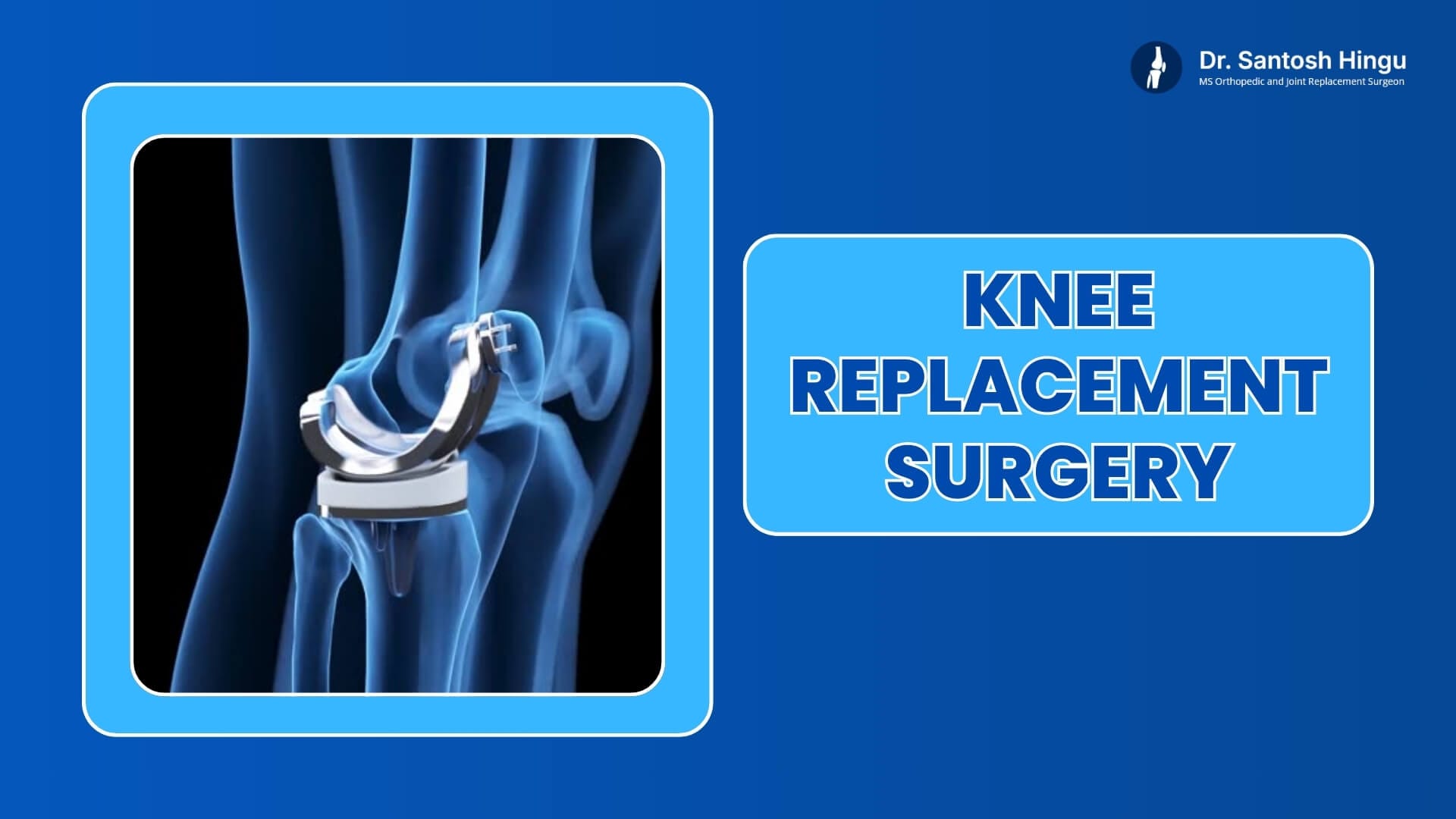 knee replacement surgery